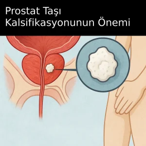 Prostat Taşı Kalsifikasyonuyla İlişkili Sorunlar